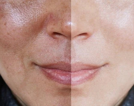 CREMA ACLARANTE CAROTONE ILUMINADORA 135ML